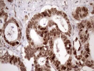 Immunohistochemistry: KLF9 Antibody (OTI8A11) - Azide and BSA Free [NBP2-70285]