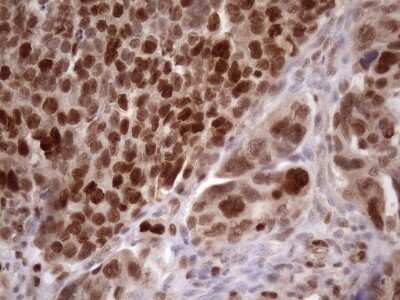 Immunohistochemistry: KLF9 Antibody (OTI8A11) - Azide and BSA Free [NBP2-70285]