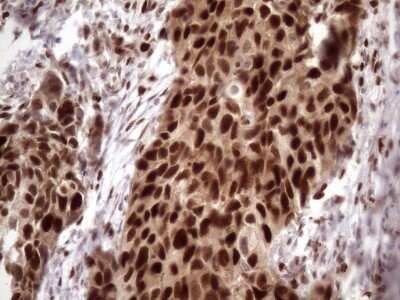 Immunohistochemistry: KLF9 Antibody (OTI8A11) - Azide and BSA Free [NBP2-70285]