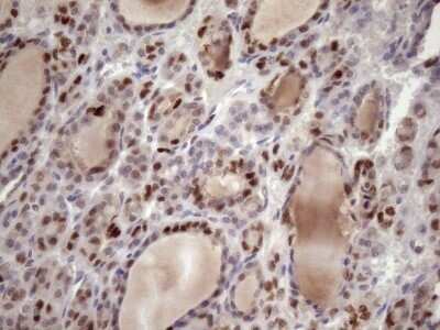 Immunohistochemistry: KLF9 Antibody (OTI8A11) - Azide and BSA Free [NBP2-70285]