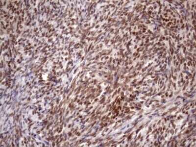 Immunohistochemistry: KLF9 Antibody (OTI8A11) - Azide and BSA Free [NBP2-70285]