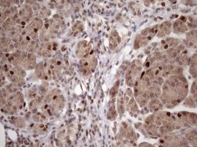 Immunohistochemistry: KLF9 Antibody (OTI8A11) - Azide and BSA Free [NBP2-70285]