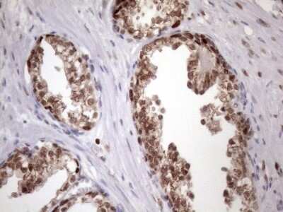 Immunohistochemistry: KLF9 Antibody (OTI8A11) - Azide and BSA Free [NBP2-70285]