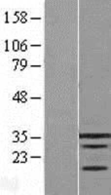 Western Blot: KLF9 Overexpression Lysate [NBL1-12323]