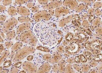 Immunohistochemistry-Paraffin: KLHDC1 Antibody [NBP3-05919]