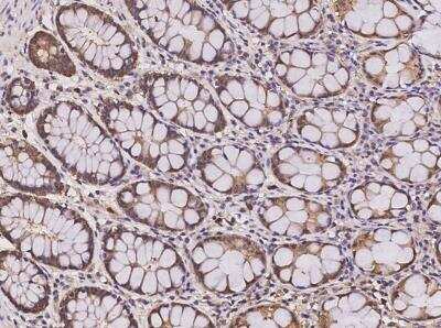 Immunohistochemistry-Paraffin: KLHDC1 Antibody [NBP3-05919]