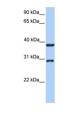 Western Blot: KLHDC1 Antibody [NBP1-55193]