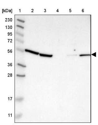 Western Blot: KLHDC1 Antibody [NBP1-82616]