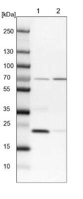 Western Blot: KLHDC10 Antibody [NBP1-81528]