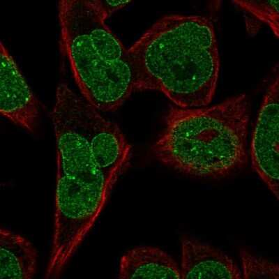 Immunocytochemistry/ Immunofluorescence: KLHDC2 Antibody [NBP2-14163]