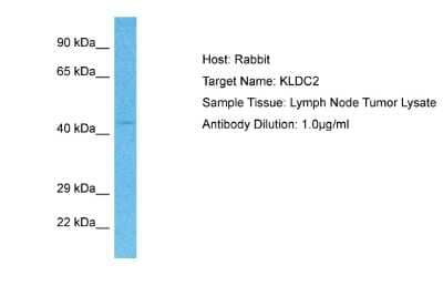 Western Blot: KLHDC2 Antibody [NBP2-85159]