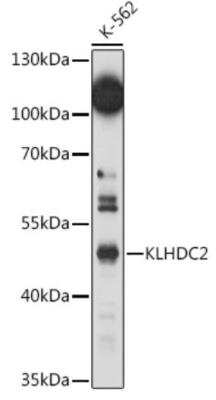 Western Blot: KLHDC2 AntibodyAzide and BSA Free [NBP3-04568]