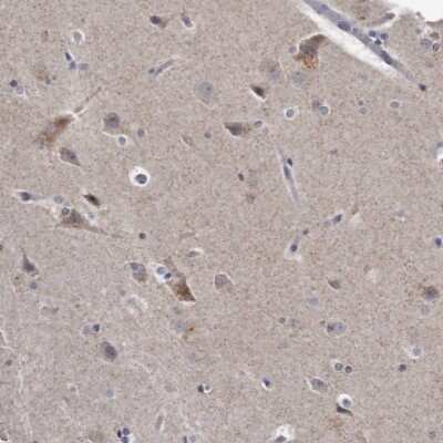 Immunohistochemistry-Paraffin: KLHDC3 Antibody [NBP1-85195]