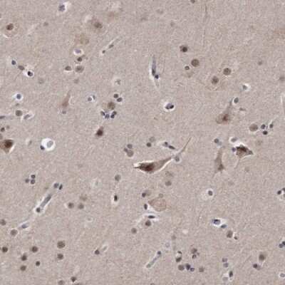 Immunohistochemistry-Paraffin: KLHDC3 Antibody [NBP1-85196]