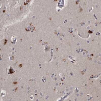 Immunohistochemistry-Paraffin: KLHDC3 Antibody [NBP1-85197]