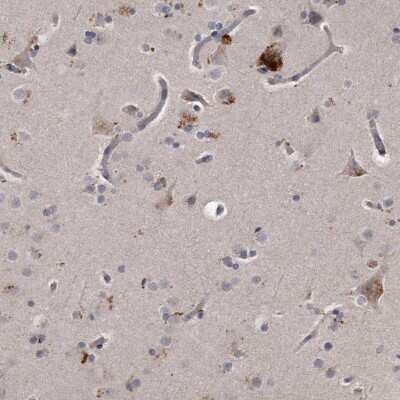 Immunohistochemistry-Paraffin: KLHDC3 Antibody [NBP1-85198]