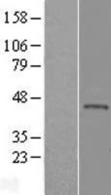 Western Blot: KLHDC3 Overexpression Lysate [NBL1-12326]