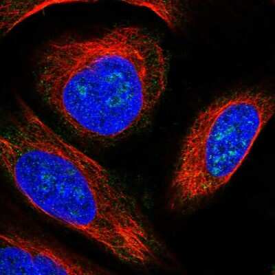 Immunocytochemistry/ Immunofluorescence: KLHDC4 Antibody [NBP1-85129]
