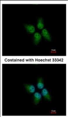 Immunocytochemistry/ Immunofluorescence: KLHDC4 Antibody [NBP2-17072]