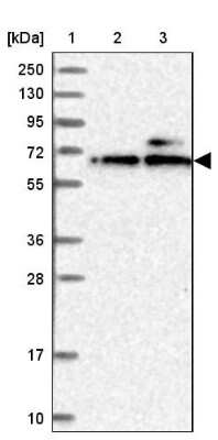 Western Blot: KLHDC4 Antibody [NBP1-85129]
