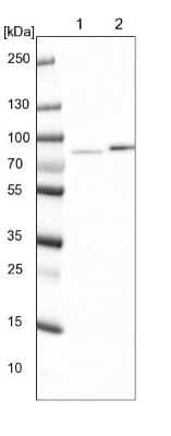 Western Blot: KLHDC4 Antibody [NBP1-85129]