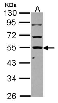 Western Blot: KLHDC4 Antibody [NBP2-17072]