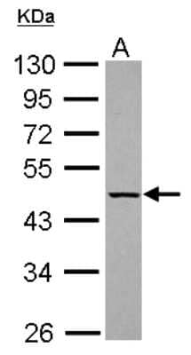 Western Blot: KLHDC4 Antibody [NBP2-17073]