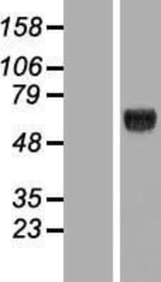 Western Blot: KLHDC4 Overexpression Lysate [NBL1-12327]