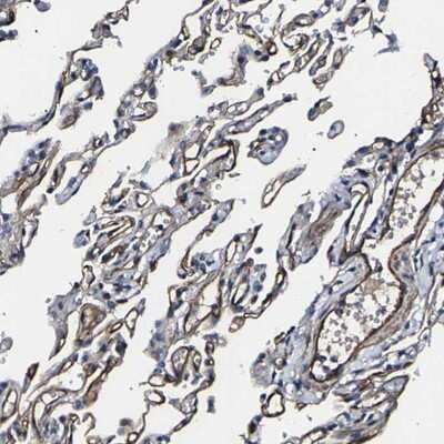 Immunohistochemistry-Paraffin: KLHDC5 Antibody [NBP1-90612]