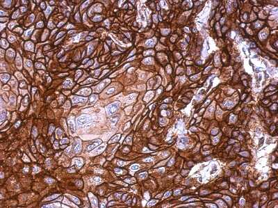 Immunohistochemistry-Paraffin: KLHDC5 Antibody [NBP2-17074]