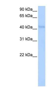 Western Blot: KLHDC5 Antibody [NBP1-91421]