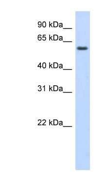 Western Blot: KLHDC5 Antibody [NBP1-91422]