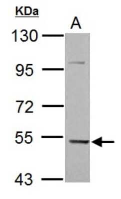 Western Blot: KLHDC5 Antibody [NBP2-17074]