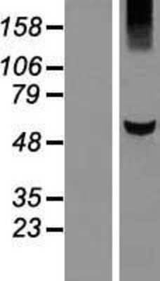 Western Blot: KLHDC5 Overexpression Lysate [NBP2-06615]