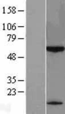 Western Blot: KLHDC7B Overexpression Lysate [NBL1-12328]