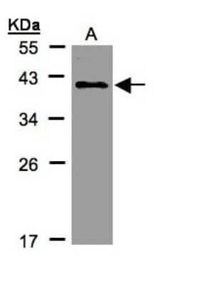 Western Blot: KLHDC8A Antibody [NBP1-31181]