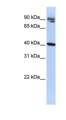 Western Blot: KLHDC8A Antibody [NBP1-57421]