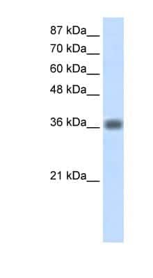 Western Blot: KLHDC8A Antibody [NBP1-57422]