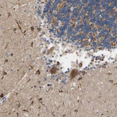 Immunohistochemistry-Paraffin: KLHDC8B Antibody [NBP1-82704]