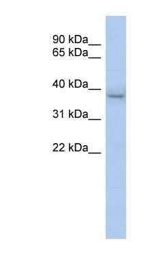 Western Blot: KLHDC8B Antibody [NBP1-70591]