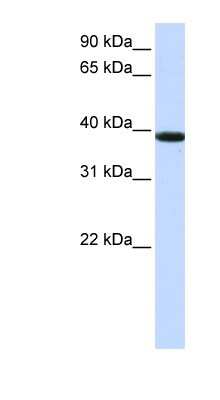 Western Blot: KLHDC8B Antibody [NBP1-70592]