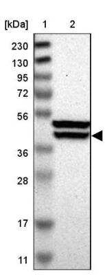 Western Blot: KLHDC8B Antibody [NBP1-82703]