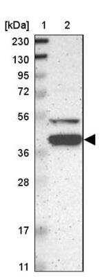 Western Blot: KLHDC8B Antibody [NBP1-82704]