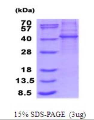 SDS-PAGE: Recombinant Human KLHDC8B His Protein [NBP2-51874]