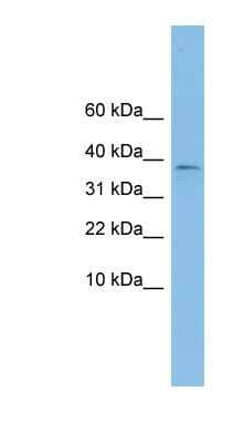 Western Blot: KLHDC9 Antibody [NBP1-57735]