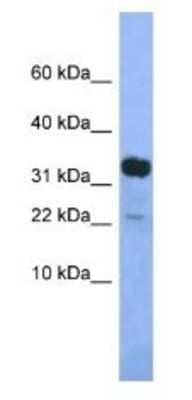 Western Blot: KLHDC9 Antibody [NBP1-79471]