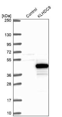 Western Blot: KLHDC9 Antibody [NBP1-83068]