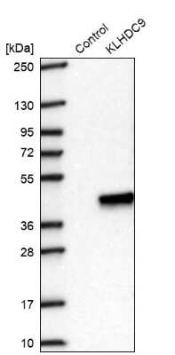 Western Blot: KLHDC9 Antibody [NBP2-48547]