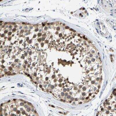 Immunohistochemistry-Paraffin: KLHL1 Antibody [NBP1-83551]