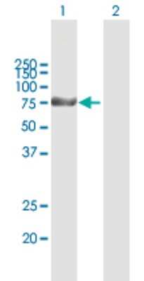 Western Blot: KLHL1 Antibody [H00057626-B01P]